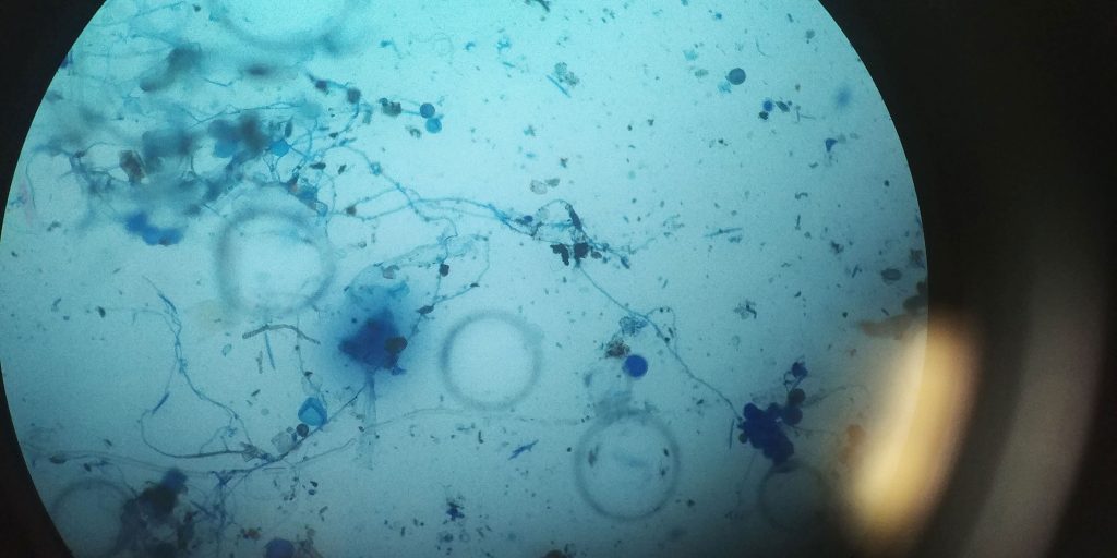 A view of fungi sampled from rain through a microscope, appearing as dark blue blotches and squiggles against a light blue circle.