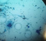 A view of fungi sampled from rain through a microscope, appearing as dark blue blotches and squiggles against a light blue circle.